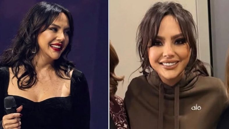 Ebru Gündeş’in Estetik Sonrası Değişimi gündem oldu